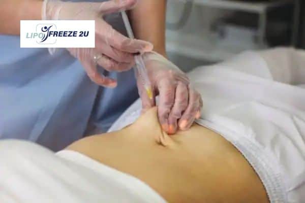 How Does Aqualyx Fat Dissolving Injection Work to Break Down Fat Woking?