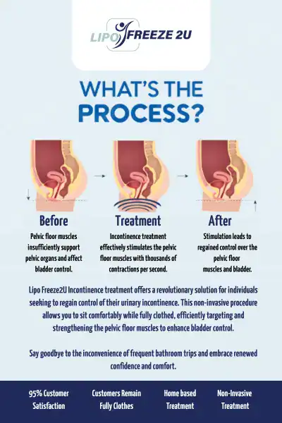 Diagram of how incontinence treatment Woking works.