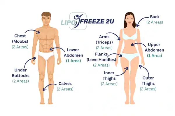 Areas you can have fat freezing treatment Woking