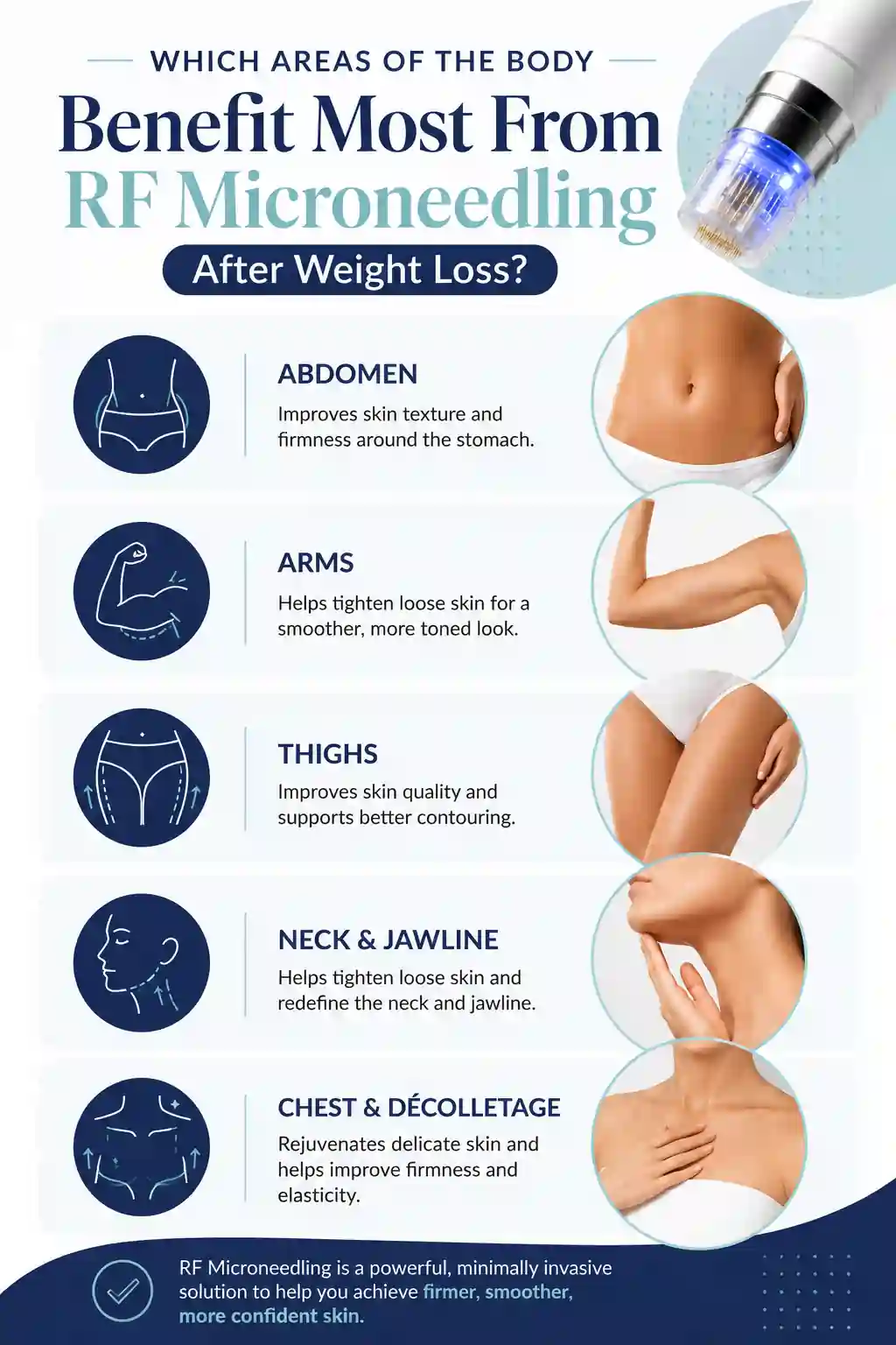 Which Areas of the Body Benefit Most From RF Microneedling After Weight Loss Woking